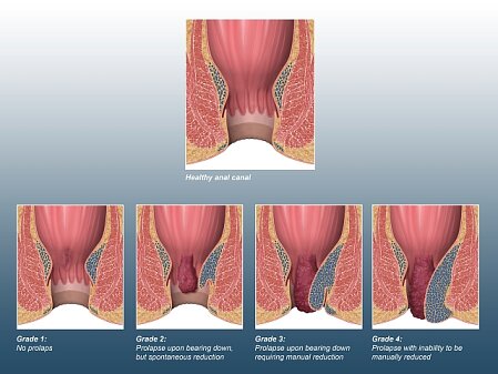 adam kaeding add Spontaneous Anal photo