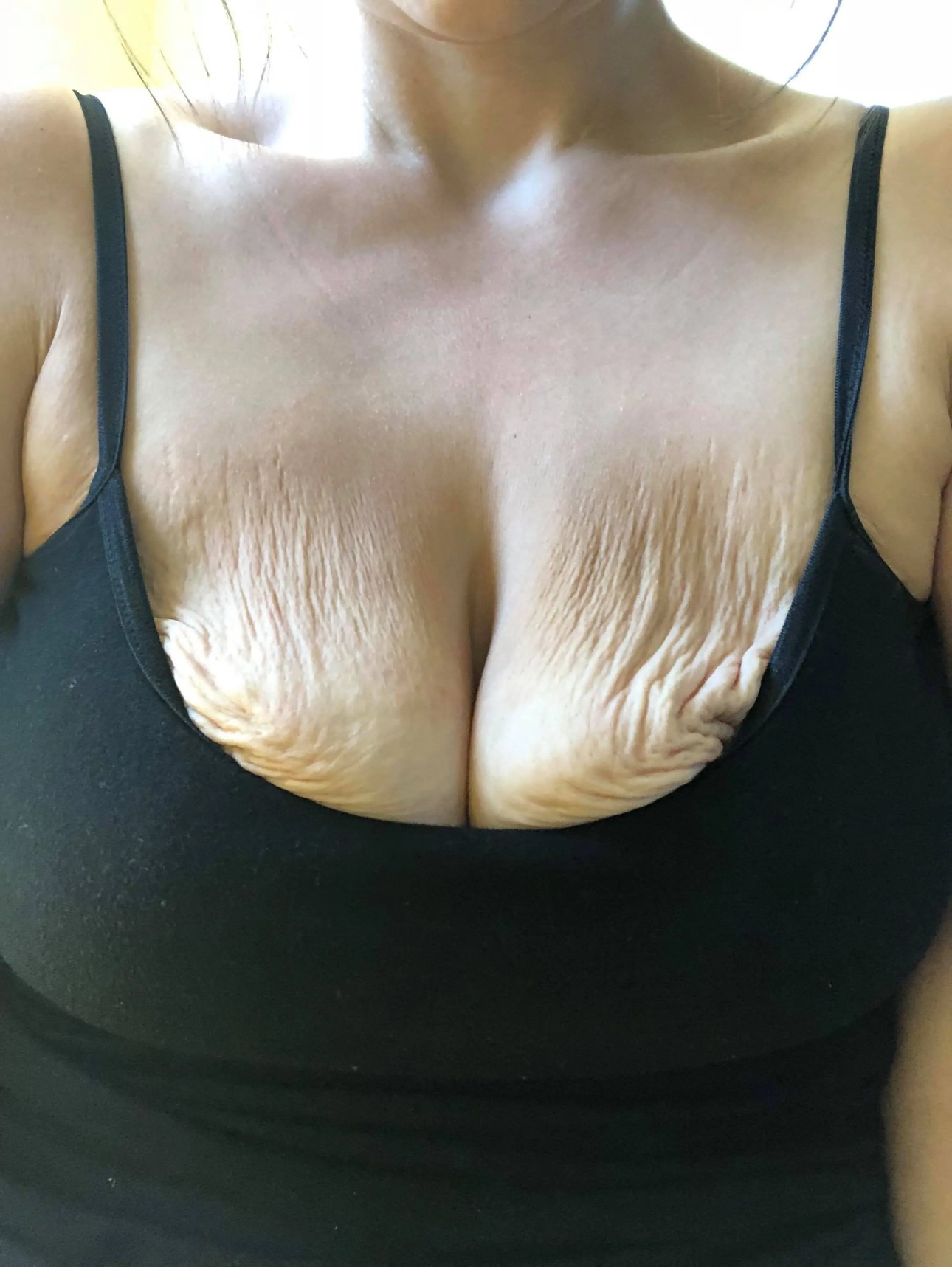 Huge Droopy Tits 24326