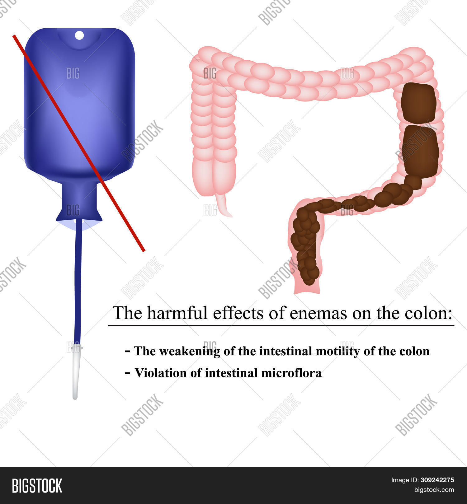 damien bolger add Enema Masterbation photo